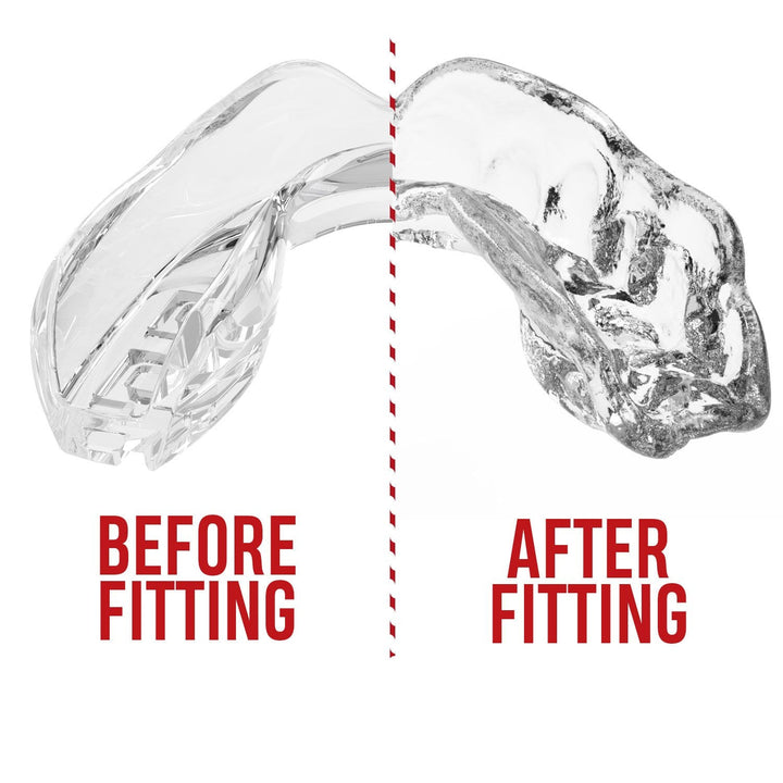SafeJawz Intro Series Mouthguard